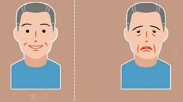 میاستنی گراویس چیست؟ / این افتادگی چشم را جدی بگیرید + فیلم