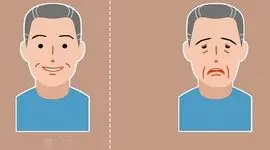 میاستنی گراویس چیست؟ / این افتادگی چشم را جدی بگیرید + فیلم