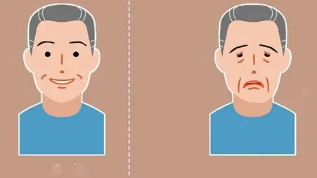 میاستنی گراویس چیست؟ / این افتادگی چشم را جدی بگیرید + فیلم