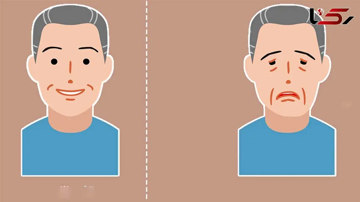 میاستنی گراویس چیست؟ / این افتادگی چشم را جدی بگیرید + فیلم