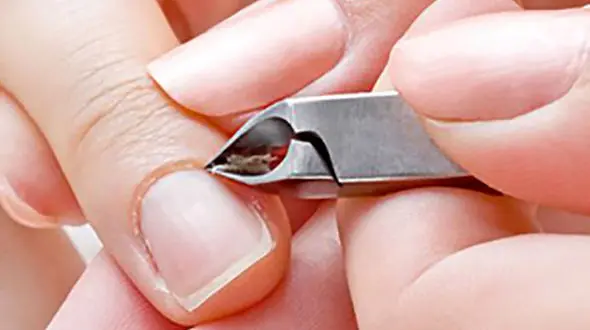 چرا نباید ریشه کنار ناخن کنده شود؟