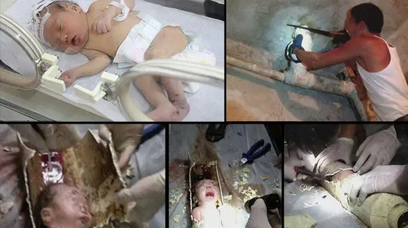 نجات معجزآسای نوزاد رها شده از لوله فاضلاب یک ساختمان / مادر این کودک دستگیر شد