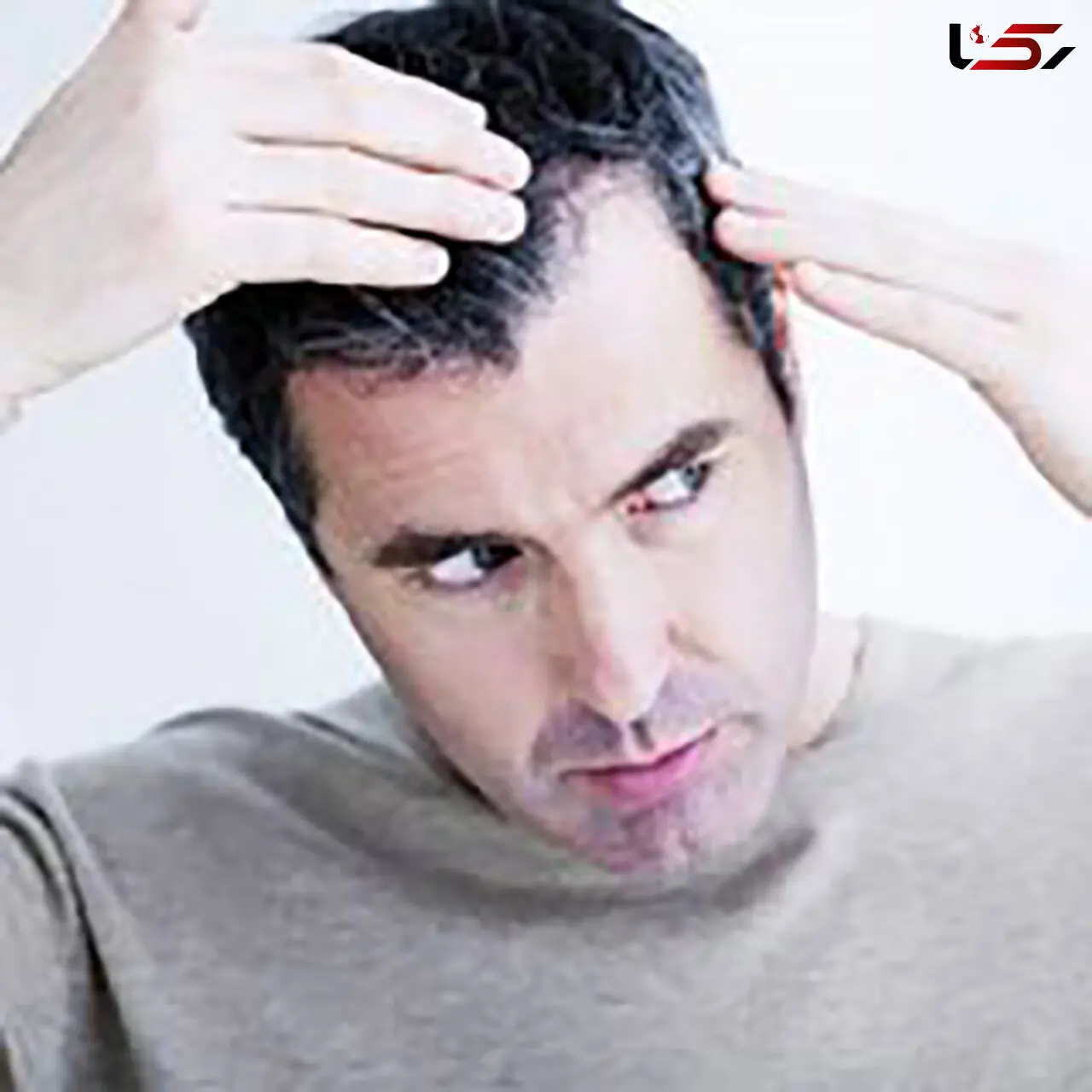 مهم ترین دلایل سفید شدن مو + راه های درمان