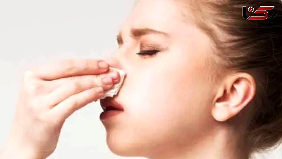 روش‌ های فوری برای متوقف کردن خون‌ دماغ در چند دقیقه