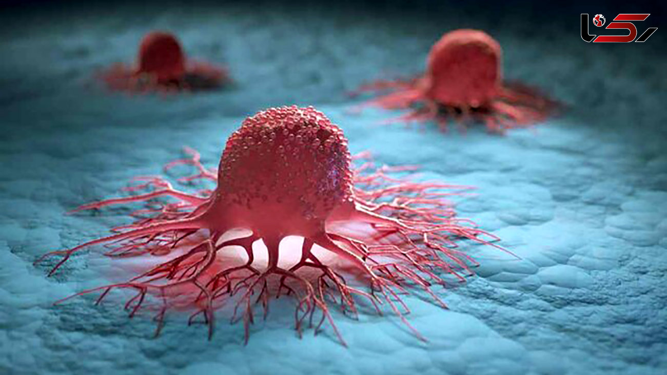 کشف روشی برای نابودی سلول‌های سرطانی