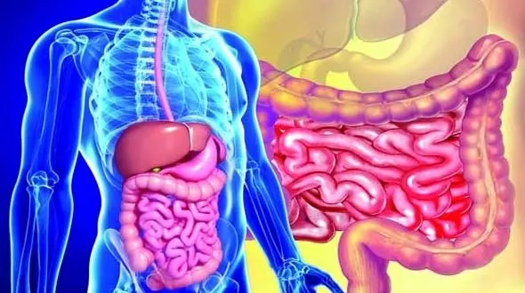 عادات ناسالم و احتمال ابتلا به سرطان روده