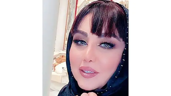 تغییر چهره عجیب بهنوش بختیاری ! + عکس تاج میلیاردی اش