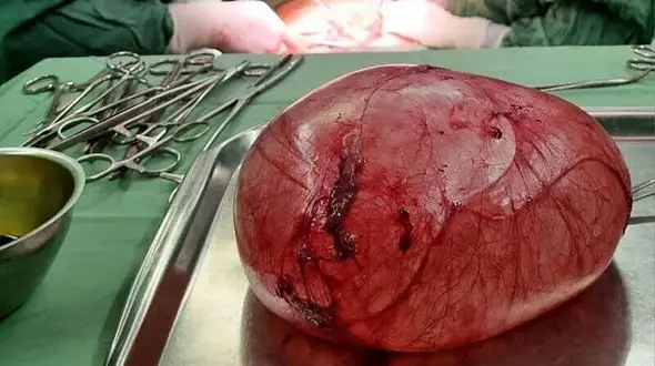 راز شکم برآمده دختر 18 ساله چه بود / در اسفراین رخ داد + عکس و جزییات