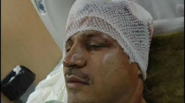 مروری بر حادثه تلخ و تصادفات شدید هنرمندان و سلبریتی های ایرانی/ از شکستن سر علی دایی تا سوپراستار زن محبوبی که بعد 6 ماه کما فوت کرد