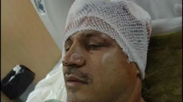 مروری بر حادثه تلخ و تصادفات شدید هنرمندان و سلبریتی های ایرانی/ از شکستن سر علی دایی تا سوپراستار زن محبوبی که بعد 6 ماه کما فوت کرد
