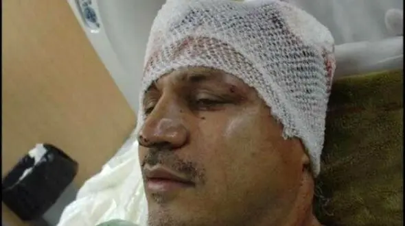 مروری بر حادثه تلخ و تصادفات شدید هنرمندان و سلبریتی های ایرانی/ از شکستن سر علی دایی تا سوپراستار زن محبوبی که بعد 6 ماه کما فوت کرد