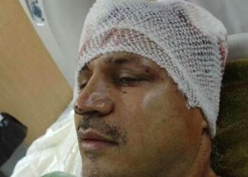 مروری بر حادثه تلخ و تصادفات شدید هنرمندان و سلبریتی های ایرانی/ از شکستن سر علی دایی تا سوپراستار زن محبوبی که بعد 6 ماه کما فوت کرد
