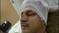 مروری بر حادثه تلخ و تصادفات شدید هنرمندان و سلبریتی های ایرانی/ از شکستن سر علی دایی تا سوپراستار زن محبوبی که بعد 6 ماه کما فوت کرد