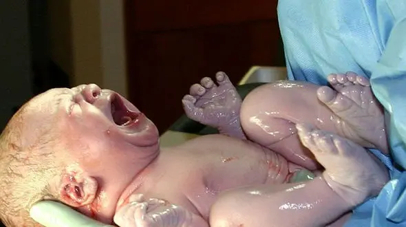 دختری که در بیمارستان پسر شد / تحقیقات قضایی آغاز شد