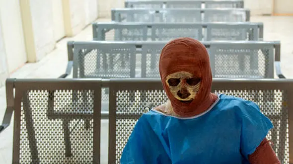 سوختن 4 نوجوان گیلانی در آخرین ساعت های سال 99