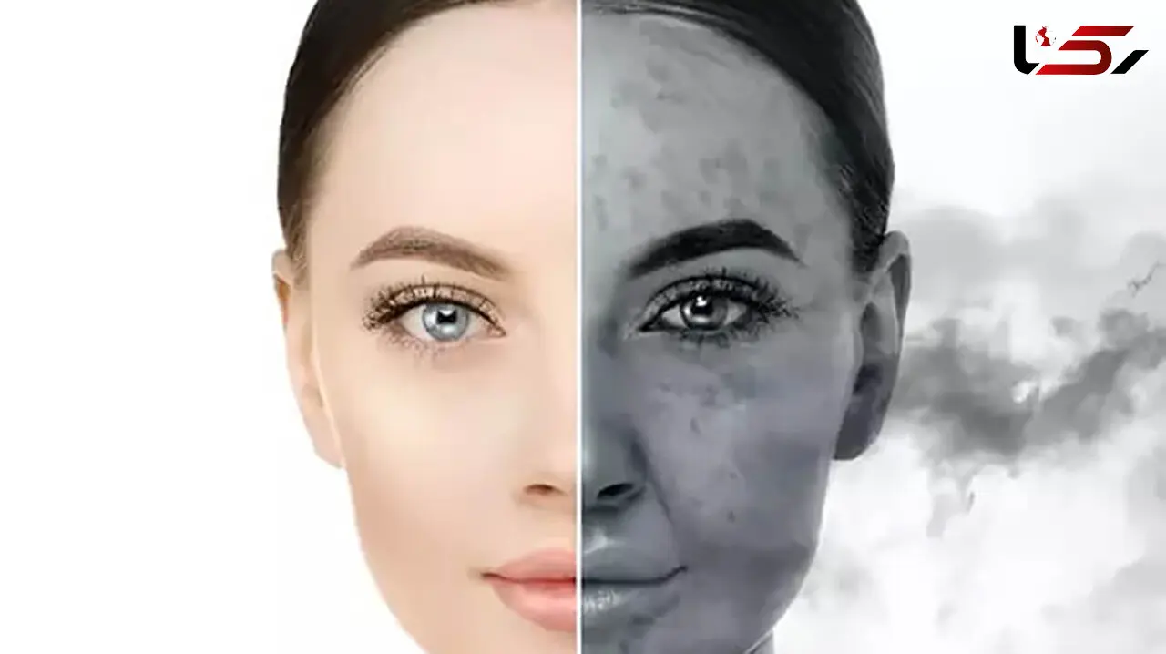 آلودگی هوا چگونه بر پوست تاثیر منفی نگذارد؟