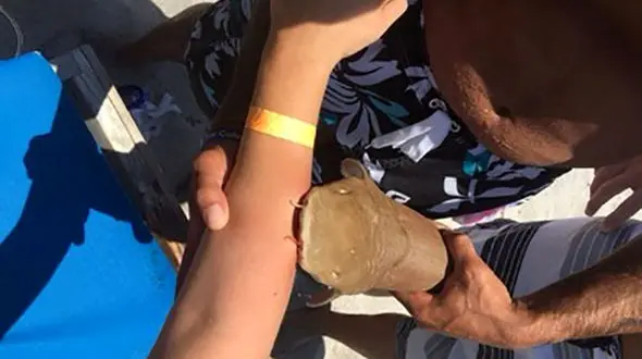 زن دست در دهان کوسه از ساحل به بیمارستان رفت + عکس