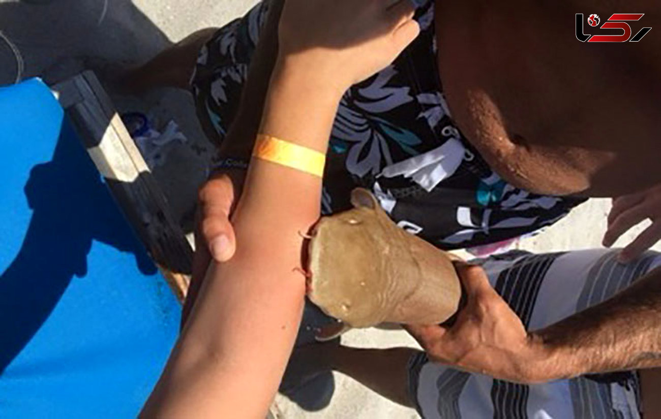 زن دست در دهان کوسه از ساحل به بیمارستان رفت + عکس