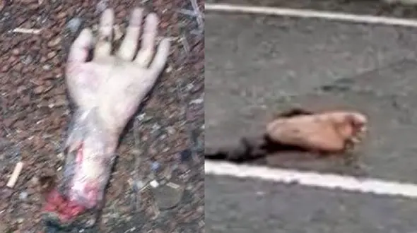 شوخی عجیب با دست و پاهای قطع شده انسان در وسط بزرگراه !+ عکس  16+ 