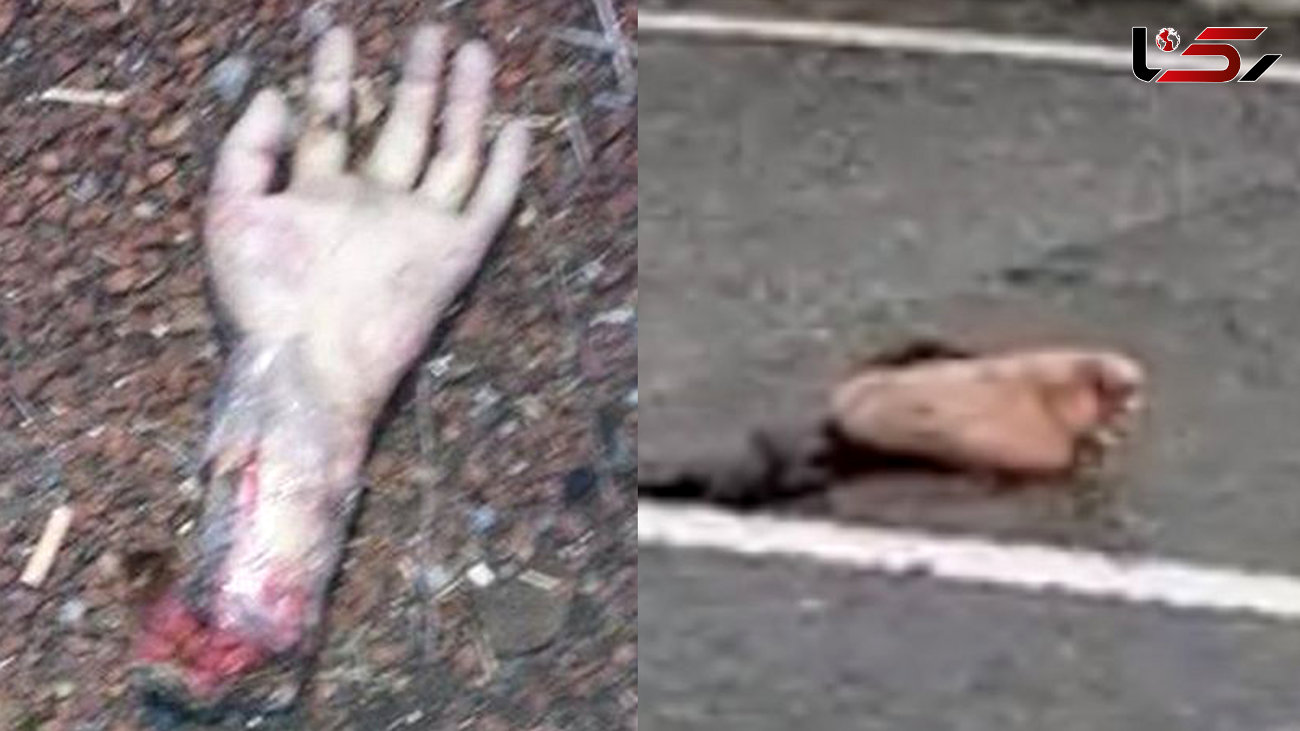 شوخی عجیب با دست و پاهای قطع شده انسان در وسط بزرگراه !+ عکس  16+ 