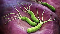 عفونت میکروبی معده و درمان موثر