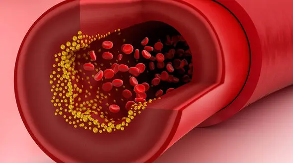 triglycerides چیست ؟ + جدول عملکرد اصلی تری گلیسرید