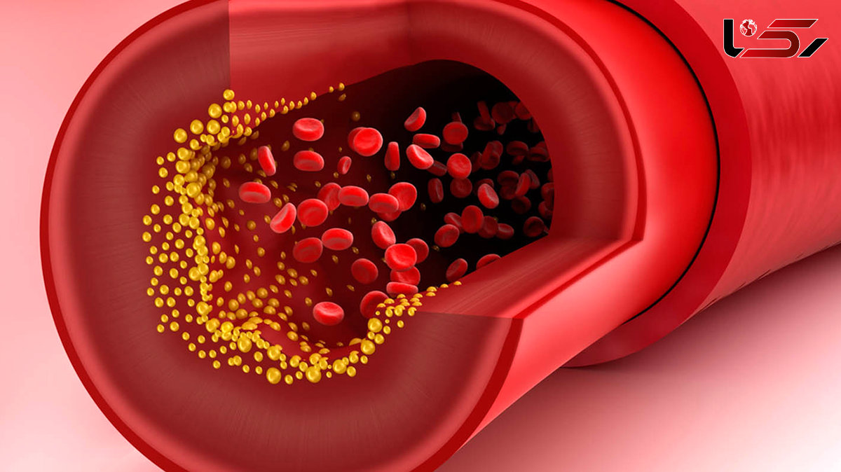 triglycerides چیست ؟ + جدول عملکرد اصلی تری گلیسرید