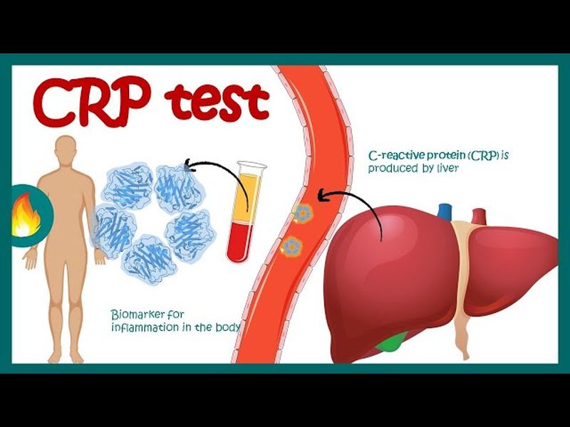 آزمایش CRP