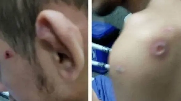 عکس های دلخراش از شکنجه پسر عقب افتاده / دادگستری مازندران وارد عمل شد