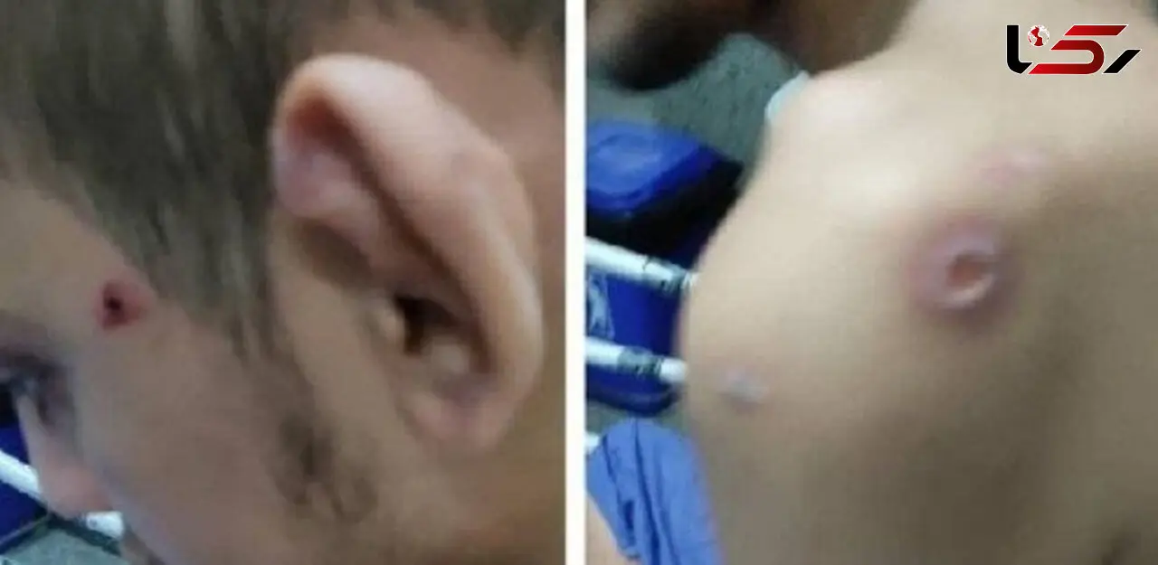 عکس های دلخراش از شکنجه پسر عقب افتاده / دادگستری مازندران وارد عمل شد