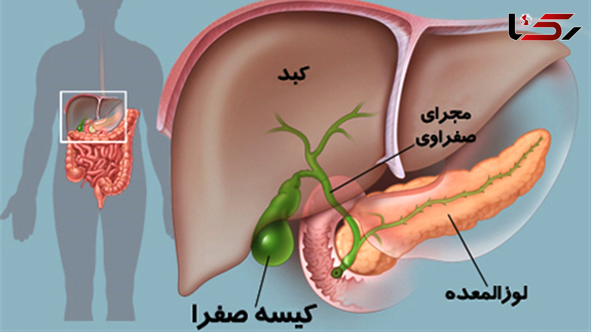 لوزالمعده چیست؟