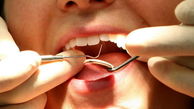 توصیه های طلایی برای ایمنی دندان ها