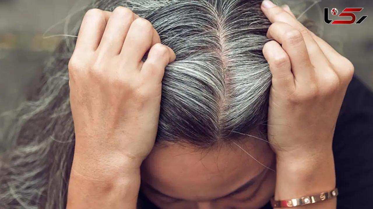 دلایل سفید شدن مو‌ در سنین جوانی و راهکار درمان آن 