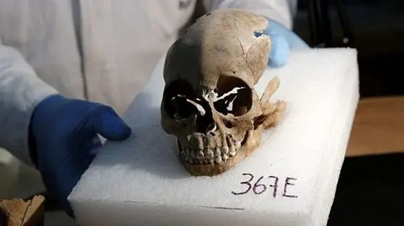 راز جمجمه انسان در جردن تهران فاش شد! + عکس