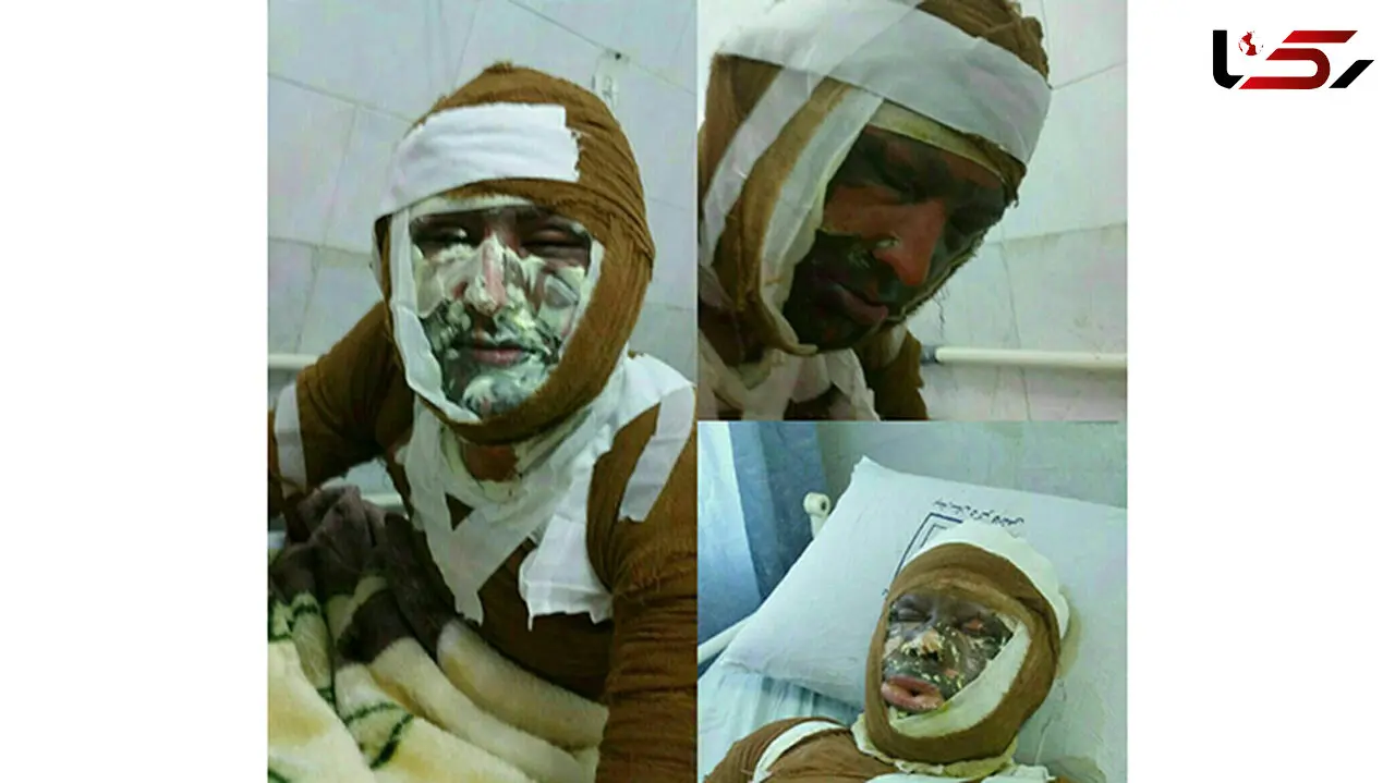 انفجار کپسول گاز در کافه خانه باعث سوختگی شدید 6 تن شد+ عکس