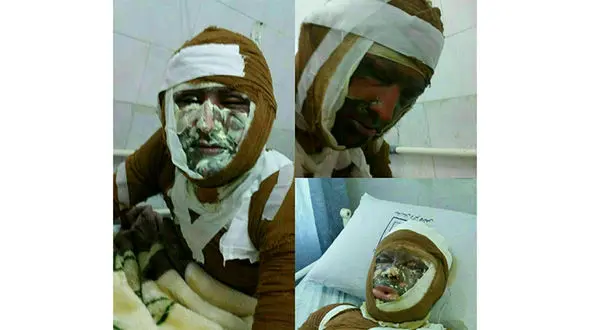 انفجار کپسول گاز در کافه خانه باعث سوختگی شدید 6 تن شد+ عکس