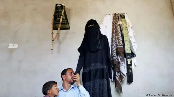 تراژدی دردناک / دست این دختر جوان قطع خواهد شد! + تصاویر