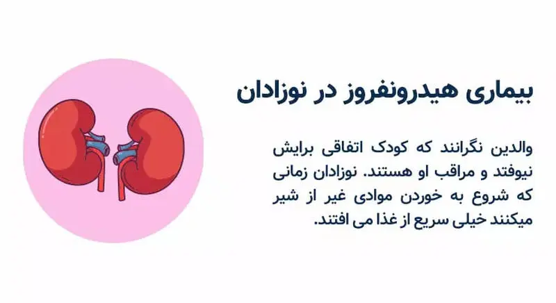 هیدرونفروز در نوزادان