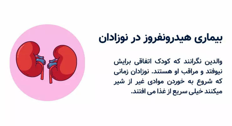 هیدرونفروز در نوزادان