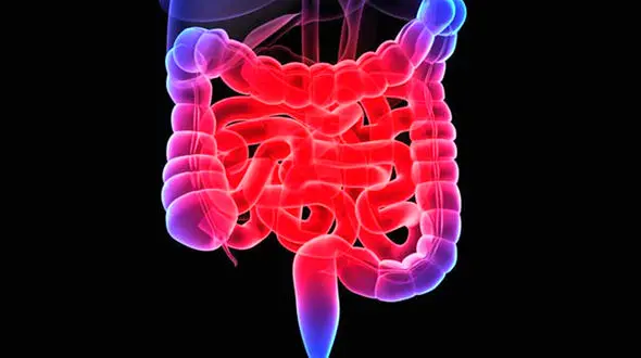 التهاب روده چیست؟ + درمان خانگی التهاب روده