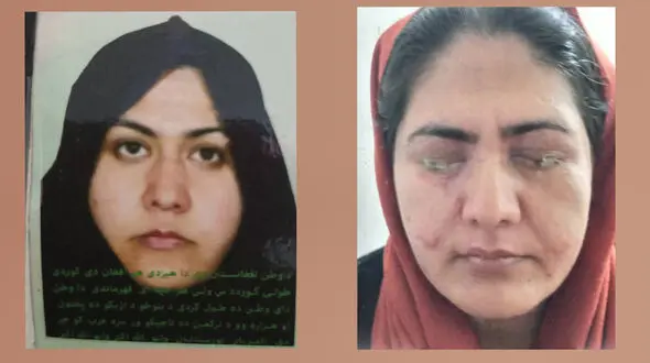 برادر در چشمان خواهر اسید ریخت تا سر کار نرود!/ این زن به کمک ما نیاز دارد + فیلم