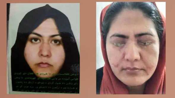 برادر در چشمان خواهر اسید ریخت تا سر کار نرود!/ این زن به کمک ما نیاز دارد + فیلم