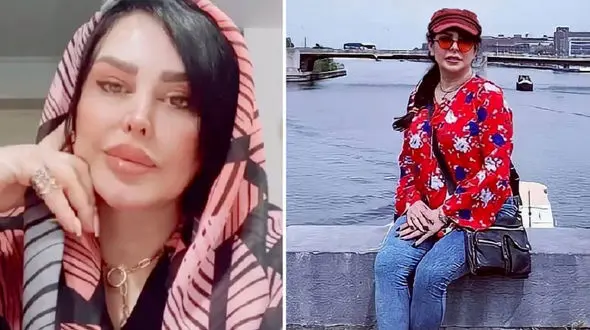 فلور نظری قبل  عمل  زیبایی اش این شکلی بود! / باور نمی کنید !