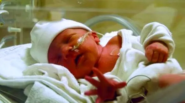  آمار بالای «سزارین» در ایران