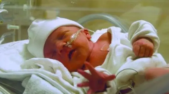  آمار بالای «سزارین» در ایران