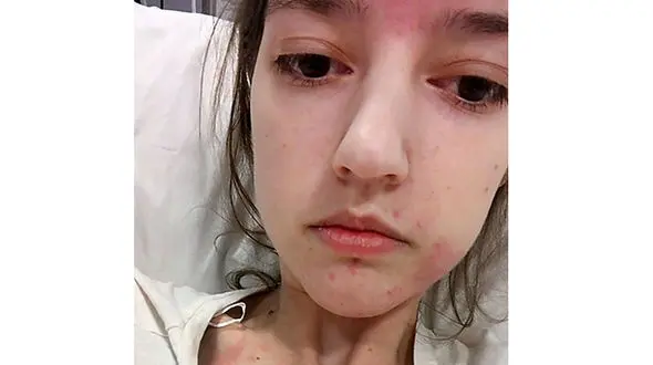 این دختر 20 ساله  با قلب غذا می خورد + عکس