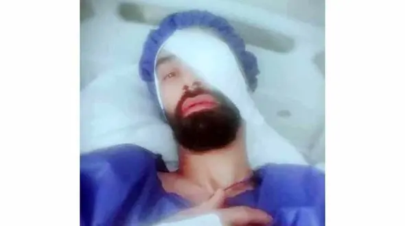 فوتبالیست ملی پوش ایرانی بینایی خود را از دست داد+ عکس دردناک