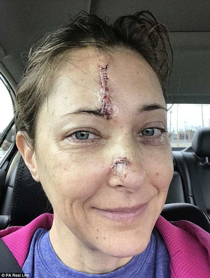 4DBFA93900000578-5899799-Janet_Lujan_43_had_to_have_reconstructive_surgery_to_rebuild_her-m-23_1530260043215