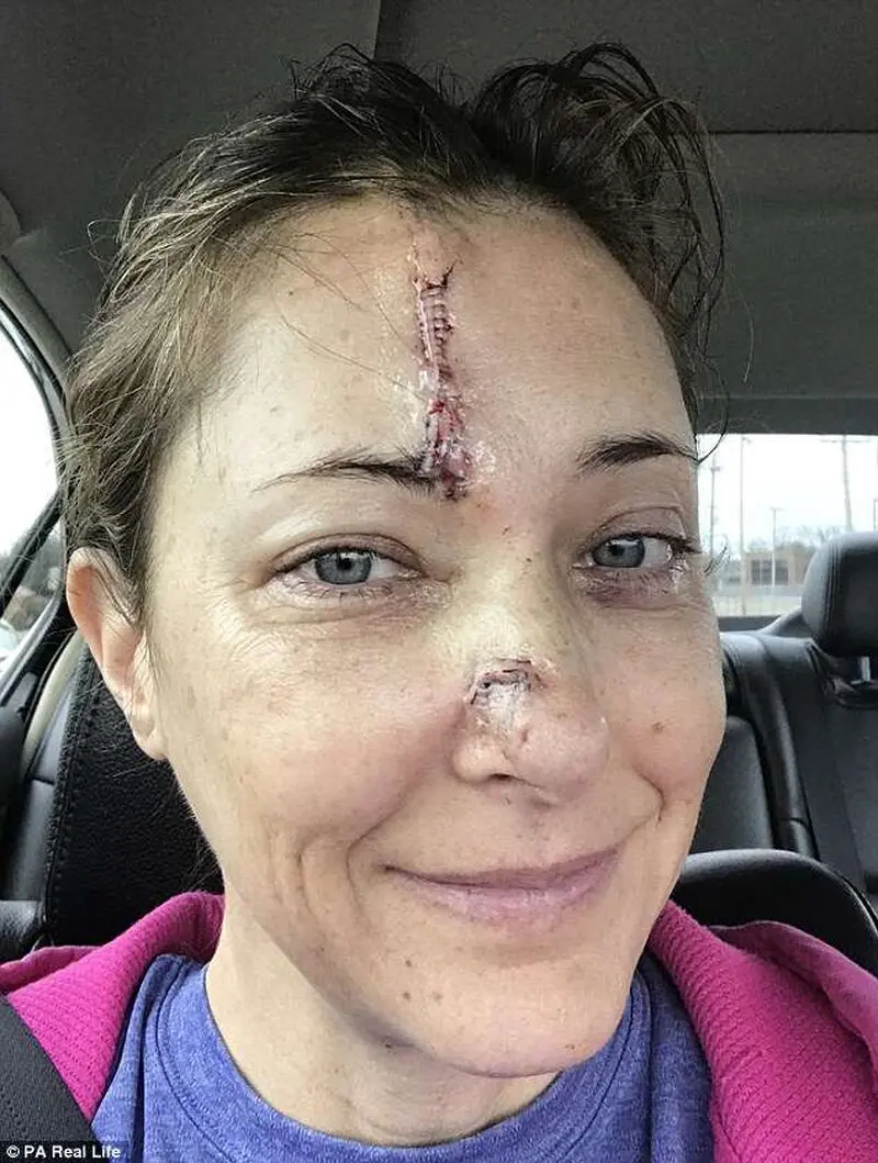 4DBFA93900000578-5899799-Janet_Lujan_43_had_to_have_reconstructive_surgery_to_rebuild_her-m-23_1530260043215