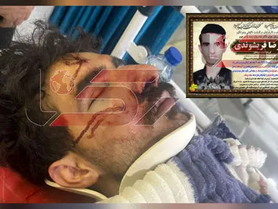 فیلم آواز جگرسوز خواننده جوان قبل مرگ روی تخت در مسیر  اتاق عمل / فکر نمیکرد آسمانی شود ../ پدر علیرضا قریشوندزی در قبرستان کنار بچه اش میخوابد ...